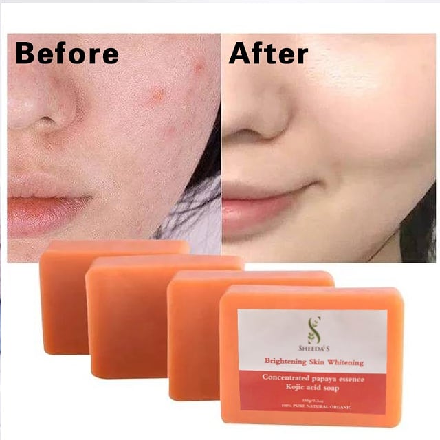 KOJIC PAPAYA SOAP